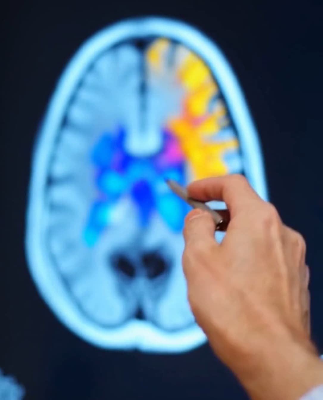 Brain story illustration